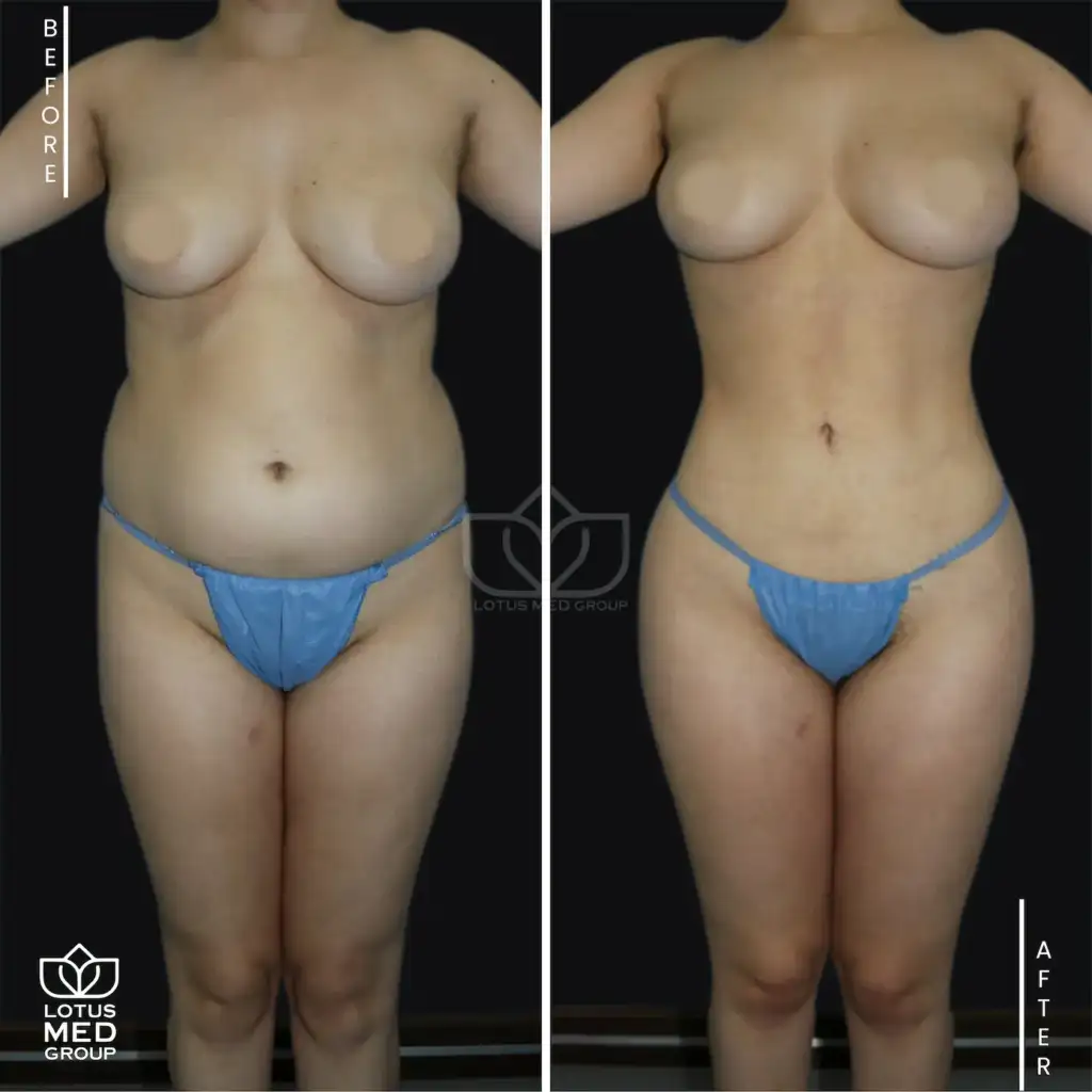 12_Mesa de trabajo 1