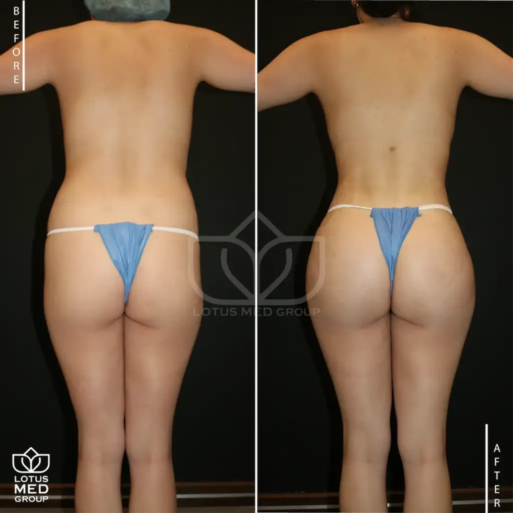 BBL_Mesa de trabajo 1