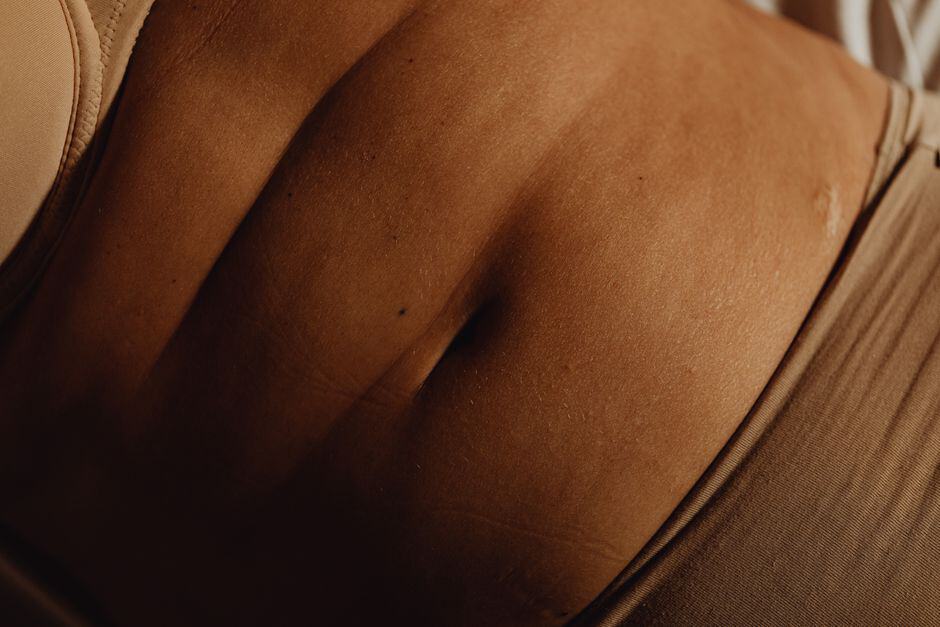 What to expect before and after abdominoplasty 1 pexels photo 6642985